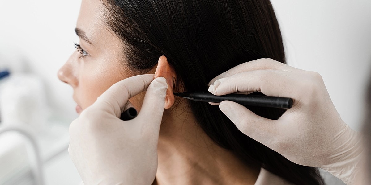 What Happens During An Otoplasty Procedure?